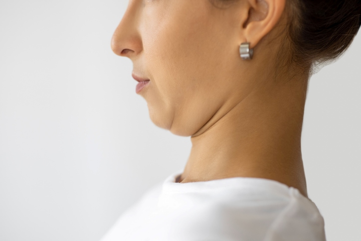 Double chin reduction treatment at Oceanshore Aesthetics and Wellness in Palm Coast, FL