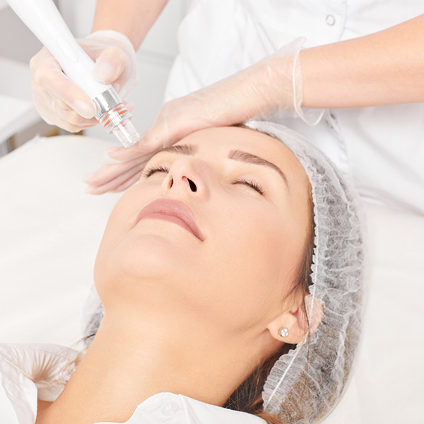 Non-Surgical-PDO-Face-Lifts-1457862176